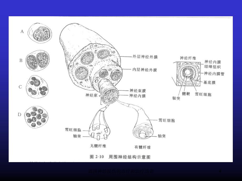 周围神经损伤的诊疗和治疗培训培训课件_第4页